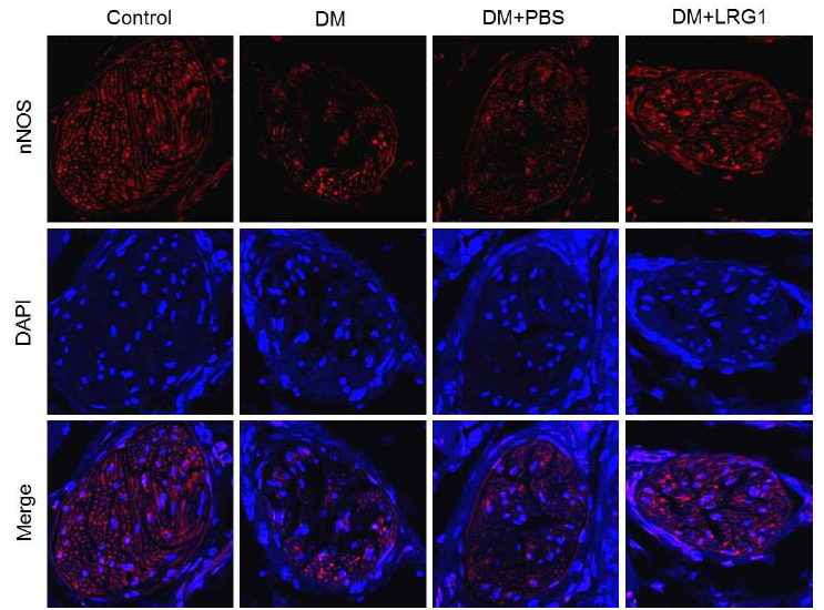 LRG1 transfer restores nNOS expression in the dorsal nerve bundle of diabetic mice. (LRG1 단백질의 음경 내 국소 투여가 당뇨성 발기부전모델의 음경 배부신경에서 nNOS 발현을 촉진함)