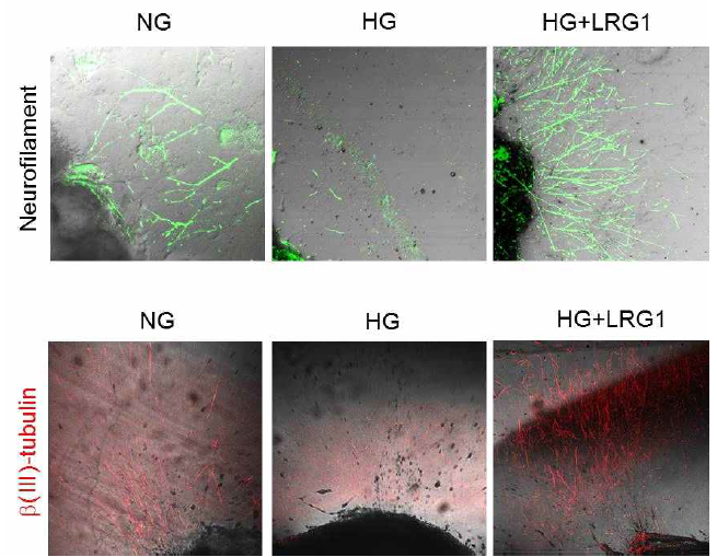 LRG1 transfer induces neurite sprouting in cultured mouse major pelvic ganglion (MPG). (주골반신경절을 이용한 실험에서 LRG1 단백질이 고 글루코오즈 조건에 의해 저해된 neurite sprouting을 정상 글루코오즈 조건 수준으로 회복시킴)