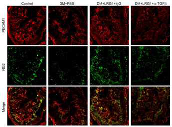 Inhibition of TGFb signaling blocks LRG1-mediated restoration of cavernous endothelial and pericyte contents in diabetic mice. (당뇨성 발기부전모델에서 LRG1 단백질에 의해 회복된 음경 내 혈관내피세포 및 혈관주위세포의 양이 TGFb blocking antibody [aTGFb]에 의해 다시 억제됨)