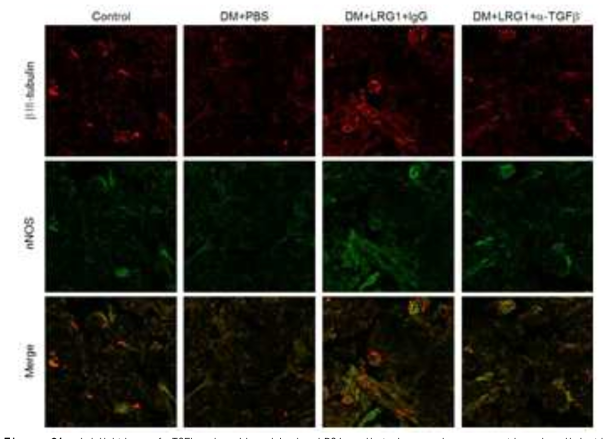 Inhibition of TGFb signaling blocks LRG1-mediated neural regeneration in diabetic mice. (당뇨성 발기부전모델에서 LRG1 단백질에 의해 회복된 음경 내 신경세포의 양이 TGFb blocking antibody [aTGFb]에 의해 다시 억제됨)