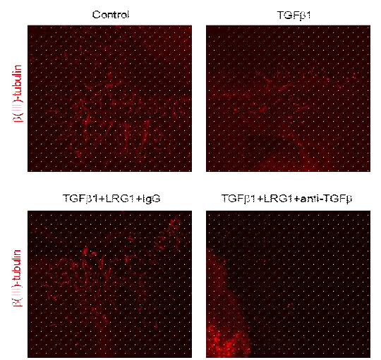 Inhibition of TGFb signaling blocks LRG1-mediated neurite sprouting in cultured mouse major pelvic ganglion (MPG) (주골반신경절을 이용한 실험에서 TGFb 처리한 조건에서 LRG1 단백질에 의해 촉진된 neurite sprouting이 TGFb 신호전달 억제제 [aTGFb]에 의해 다시 억제됨)