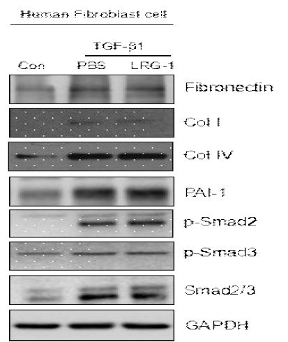 LRG1 does not affect on the TGF-beta1-induced expression of extracellular matricx protein in human penile fibroblasts. (인간의 음경에서 일차 분리배양된 섬유모세포에서 LRG1 단백질이 TGFb1에 의해 유도된 extracellular matrix protein 발현 증가를 감소시키지 못함)