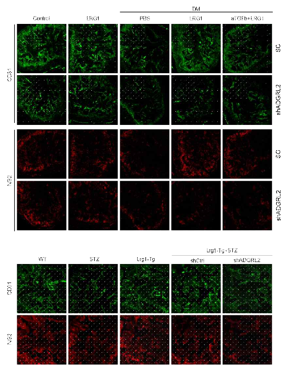 LRG1-mediated restoration of cavernous endothelial and pericyte contents via ADGRL2 pathway in wild type and LRG1 Tg diabetic mice. (당뇨마우스에서 LRG1에 의한 혈관내피세포, 혈관주위세포의 재생이 ADGRL2를 억제하였을 때는 나타나지 않음)