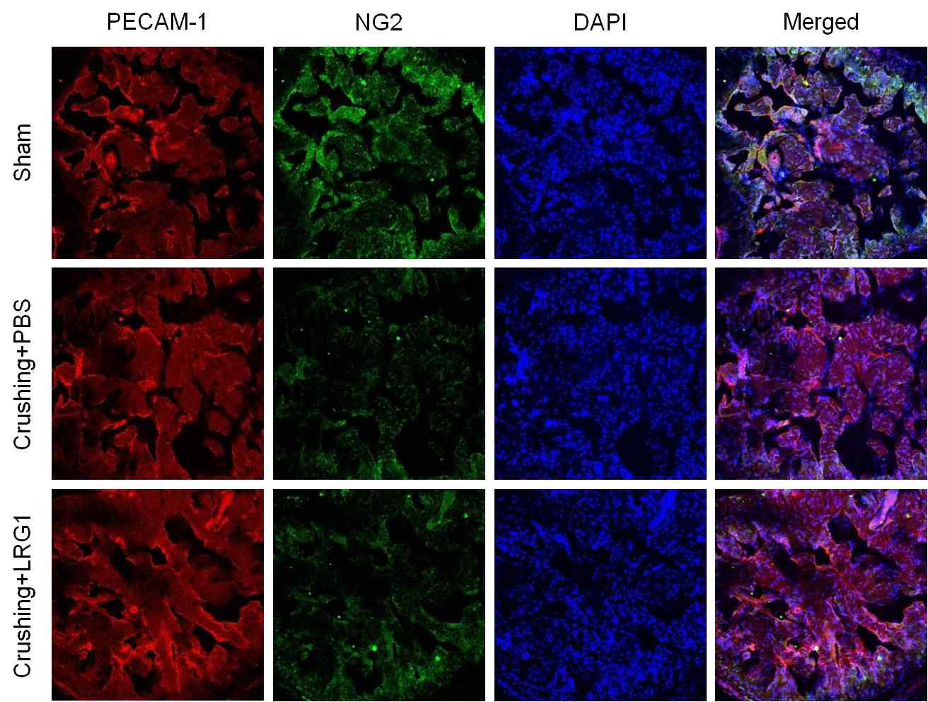 LRG1 increases cavernous endothelial cell and pericyte content in mouse model of bilateral cavernous nerve crushing