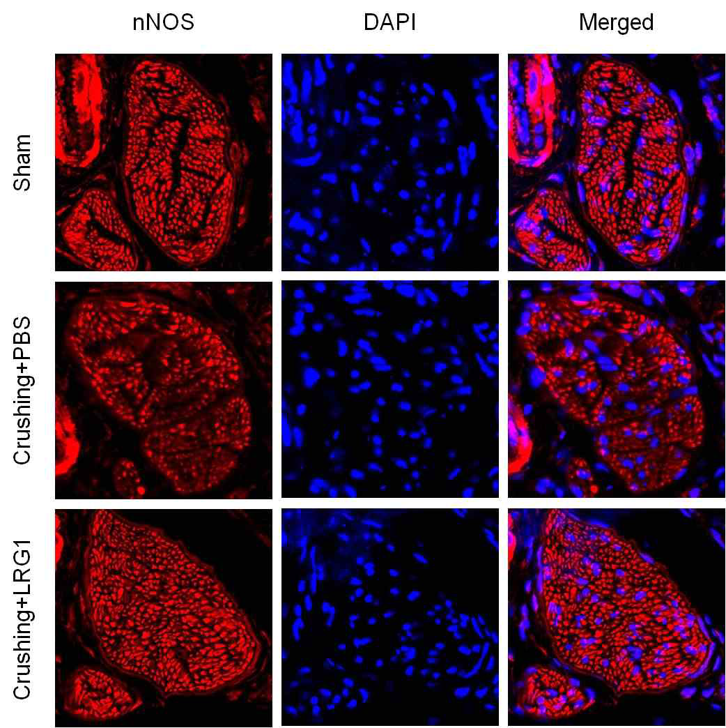 LRG1 increases nNOS exprssion in dorsal nerve bundle of bilateral cavernous nerve crushing mice