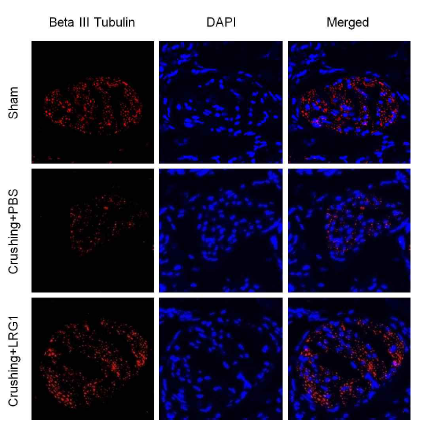 LRG1 increases Beta Ⅲ Tubulin in dorsal nerve bundle of bilateral cavernous nerve crushing mice