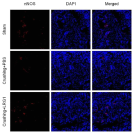 LRG1 enhances nNOS expression in cavernous tissue of bilateral cavernous nerve crushing mice