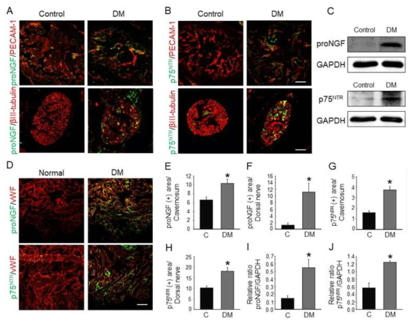 Increased proNGF and p75NTR expression under diabetic conditions. (A and B) PECAM-1 (red), βIII-tubulin (red), proNGF (green), or p75NTR (green) immunostaining in mouse cavernous tissue. (C) Representative Western blots for proNGF and p75NTR in mouse cavernous tissue. (D) vWF (red), proNGF (green), or p75NTR (green) immunostaining in human cavernous tissue. Scale bar = 100 μm (corpus cavernosum) or 25 μm (dorsal nerve bundle). (E-H) The proNGF or p75NTR immunopositive area in the corpus cavernosum and dorsal nerve bundle of control or diabetic mice was quantified by ImageJ (N = 6). *P < 0.05 vs. control group. (I and J) Normalized band intensity values for proNGF and p75NTR (N = 5). *P < 0.01 vs. control group. Data in graphs are presented as mean ± SE. DM, diabetes mellitus; VWF, von Willebrand factor