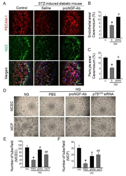 ProNGF-Ab restores cavernous endothelial cell and pericyte content, and enhances tube formation under diabetic conditions. (A) PECAM-1 (red) or NG2 (green) immunostaining in cavernous tissue from age-matched control and diabetic mice 2 weeks after receiving repeated intracavernous injections of saline (S; days -3 and 0; 20 μL) or proNGF-Ab (pNAb; days -3 and 0; 20 μg/20 μL). Nuclei were labeled with DAPI (blue). Scale bar = 100μm. (B and C) Quantification of cavernous endothelial cell and pericyte contents by ImageJ (N = 6). *P < 0.05 vs. control group; #P < 0.05 vs. saline-treated diabetic group. (D) Tube formation assay in primary cultured mouse cavernous endothelial cells (MCEC) and mouse cavernous pericytes (MCP) exposed to normal-glucose (NG) or high-glucose (HG) condition, which were treated with proNGF-Ab or siRNA for p75NTR (sip75). (E and F) Number of tubes per field (screen magnification ´40) (N = 4). *P < 0.01 vs. NG group; #P < 0.01 vs. HG + PBS group; ##P < 0.05 vs. HG + PBS group. Data in graphs are presented as mean ± SE. DM, diabetes mellitus; STZ, streptozotocin