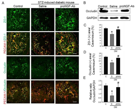 ProNGF-Ab restores cavernous endothelial cell-cell junction proteins under diabetic conditions. (A) Zonular ocludens-1 (ZO-1; green), occludin (green), or PECAM-1 (red) immunostaining in cavernous tissue from age-matched control and diabetic mice 2 weeks after receiving repeated intracavernous injections of saline (S; days -3 and 0; 20 μL) or proNGF-Ab (pNAb; days -3 and 0; 20 μg/20 μL). Scale bar = 100 μm. (B) Representative Western blots for occludin in mouse cavernous tissue. (C and D) Quantitative analysis of occludin and ZO-1 immunopositive area by ImageJ (N = 6). *P < 0.05 vs. control group; #P < 0.05 vs. saline-treated diabetic group. (E) Normalized band intensity values for occludin (N = 5). *P < 0.05 vs. control group; #P < 0.05 vs. saline-treated diabetic group. Data in graphs are presented as mean ± SE. DM, diabetes mellitus; STZ, streptozotocin