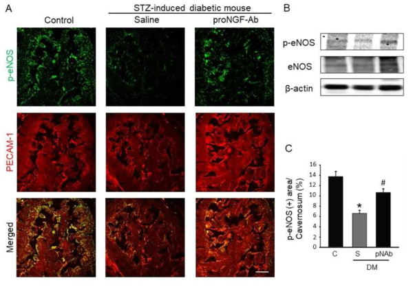 ProNGF-Ab induces cavernous eNOS phosphorylation under diabetic conditions. (A) Phospho-eNOS (p-eNOS, green) and PECAM-1 (red) immunostaining in cavernous tissue from age-matched control and diabetic mice 2 weeks after receiving repeated intracavernous injections of saline (S; days -3 and 0; 20 μL) or proNGF-Ab (pNAb; days -3 and 0; 20 μg/20 μL). Scale bar = 100 μm. (B) Representative Western blot for phospho-eNOS and eNOS in each group. Results were similar from three-independent experiments. (C) Quantitative analysis of phospho-eNOS immunopositive area by ImageJ (N = 6). *P < 0.05 vs. control group; #P < 0.05 vs. saline-treated diabetic group. Data in graphs are presented as mean ± SE. STZ, streptozotocin