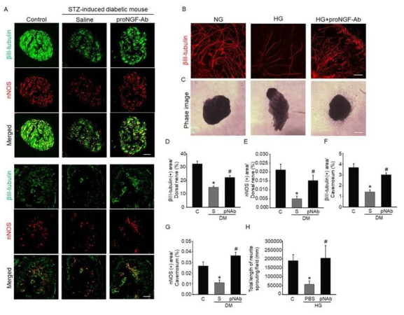 ProNGF-Ab induces neural regeneration under diabetic conditions. (A) nNOS (red) and β III-tubulin (green) staining of penis tissue from age-matched control and diabetic mice 2 weeks after receiving repeated intracavernous injections of saline (S; days -3 and 0; 20 μL) or proNGF-Ab (pNAb; days -3 and 0; 20 μg/20 μL). Scale bar = 100 μm. (B) βIII-tubulin (red) staining of mouse major pelvic ganglion (MPG) tissue exposed to normal glucose (NG) or high glucose (HG) condition, which were treated with proNGF-Ab. Scale bar = 100 μm. (C) Phase image of cultured MPG. Scale bar = 200 μm. (D-G) Quantitative analysis of βIII-tubulin and nNOS immunopositive area in corpus cavernosum or dorsal nerve bundle by ImageJ (N = 6). *P < 0.05 vs. control group; #P < 0.05 vs. saline-treated diabetic group. (H) Quantitative analysis of βIII-tubulin immunopositive neurite length by ImageJ (N = 5). *P < 0.05 vs. NG group; #P < 0.05 vs. HG + PBS group. Data in graphs are presented as mean ± SE. DM, diabetes mellitus; nNOS, neuronal nitric oxide synthase