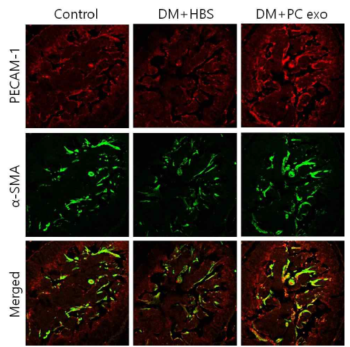 Pericyte-derived exosome increases cavernous smooth muscle cell content in diabetic mice