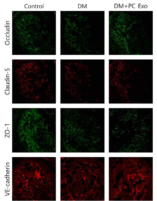 Pericyte-derived exosome restores cavernous endothelial cell-cell junction proteins in diabetic mice