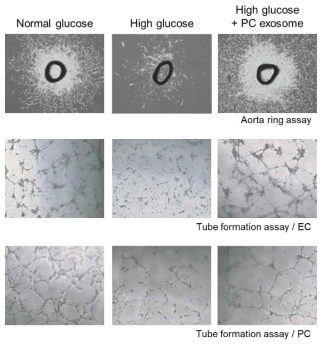 Pericyte-derived exosome induces angiogenesis in primary cultured mouse cavernous endothelial cells and pericytes