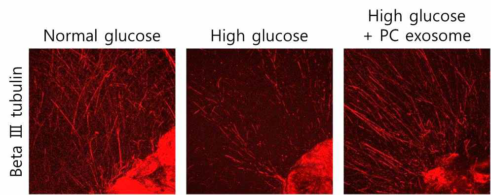 Pericyte-derived exosome induces neurite sprouting in cultured mouse major pelvic ganglion (MPG)