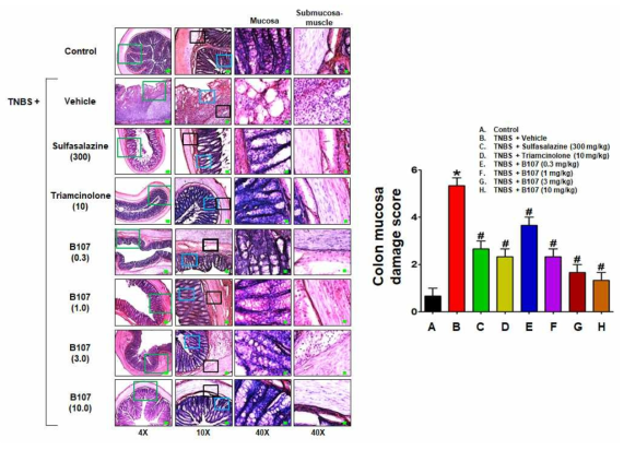 경구투여 B107에 의한 TNBS-유도 장염 억제 효과를 나타내는 장조직 H&E 염색 사진