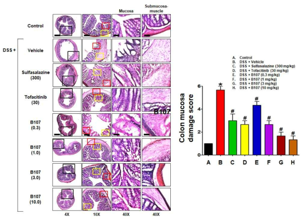 DSS-유도 마우스 장염 모델에 대한 장조직 손상에서 경구투여 B107의 치료 효과를 나타내는 장조직 H&E 염색 사진