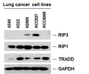 다양한 폐암 세포주의 RIP1, RIP3, TRADD 발현패턴