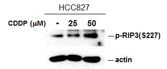 Cisplatin 처리에 의한 RIP3 단백질 활성