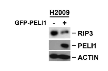 폐암 세포주 에서 PELI1 발현 조절에 따른 RIP3 단백질 안정성변화