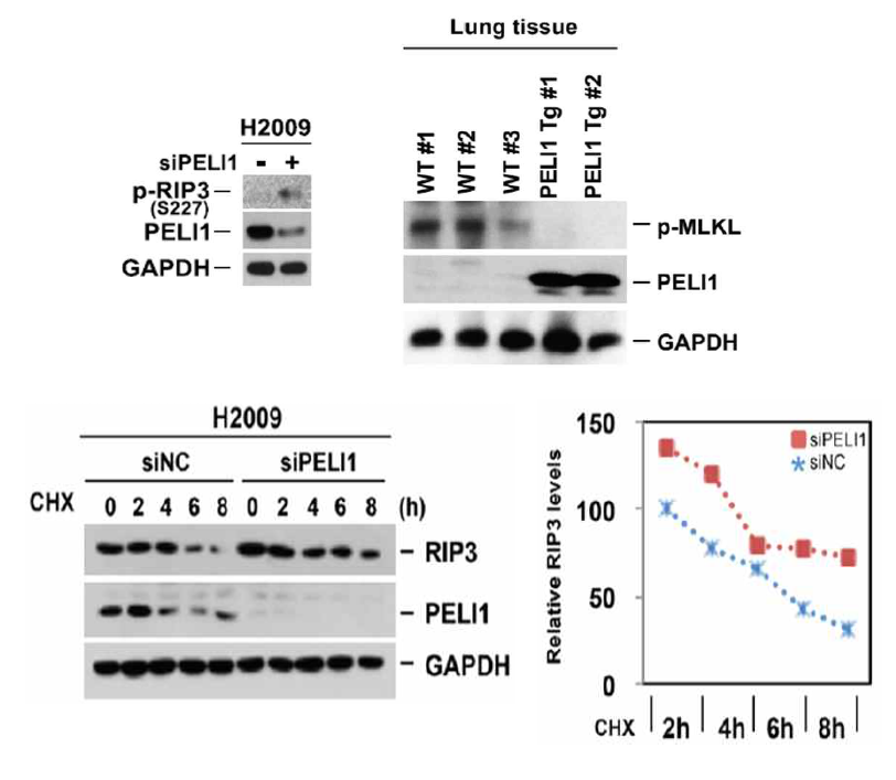 폐암 세포 주와 폐암 조직에서 PELI1발현변화에 따른 RIP3활성변화