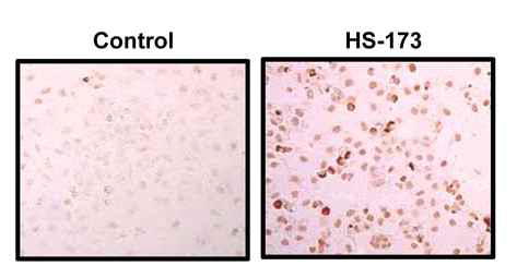 TUNEL staining