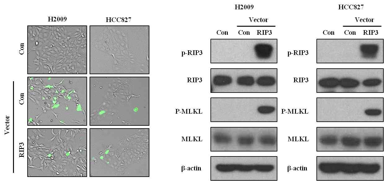 세포내에서 RIP3 발현 확인 및 necroptosis 관련 단백질 변화