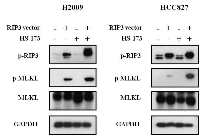 폐암 세포 내에서 RIP3 발현 벡터와 항암제 처리에 따른 MLKL의 활성