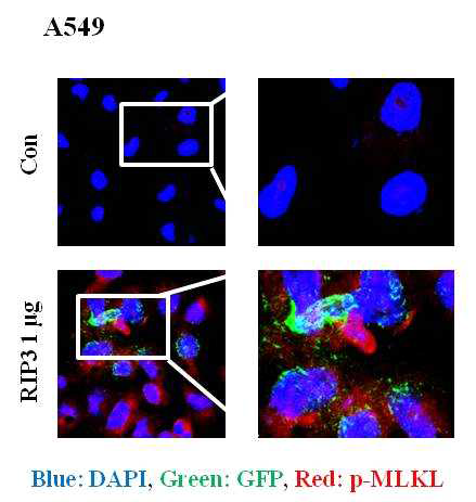 폐암 세포 내에서 RIP3 발현 벡터와 p-MLKL의 상관관계