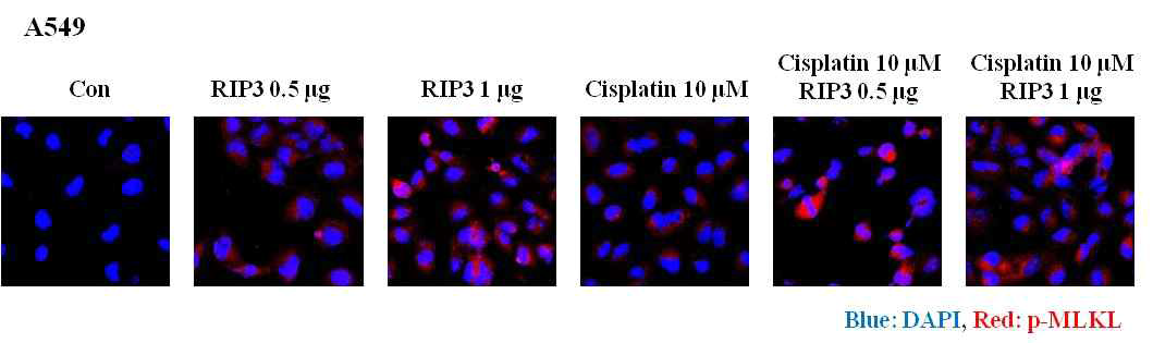 폐암 세포 내에서 RIP3 발현 벡터와 항암제 처리에 따른 p-MLKL의 활성