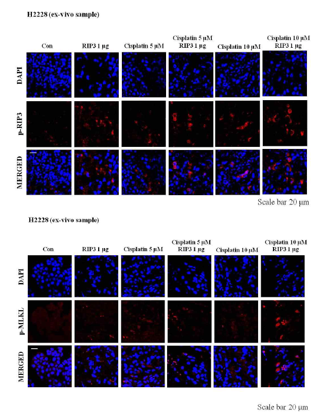 ex vivo에서 cisplatin과의 병용투여를 통한 p-RIP3와 p-MLKL의 활성