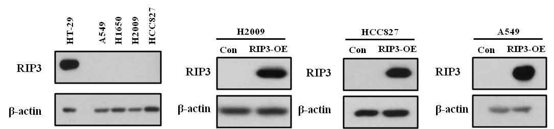 RIP3가 과발현 된 폐암 세포 주 구축