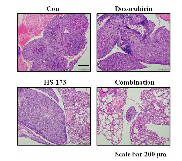 동몰 모델에서 HS-173과 Doxorubicin에 대한 H&E 염색