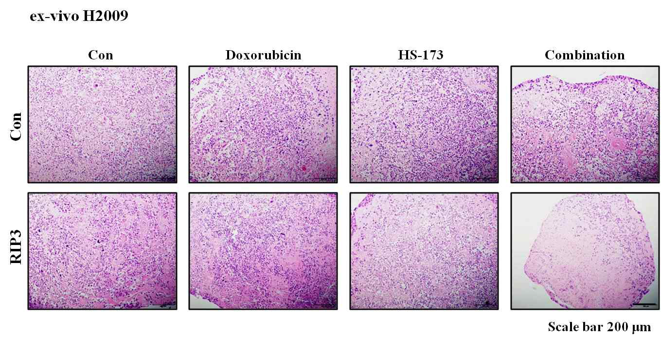 폐암 ex-vivo 모델에서 HS-173과 Doxorubicin에 대한 H&E 염색