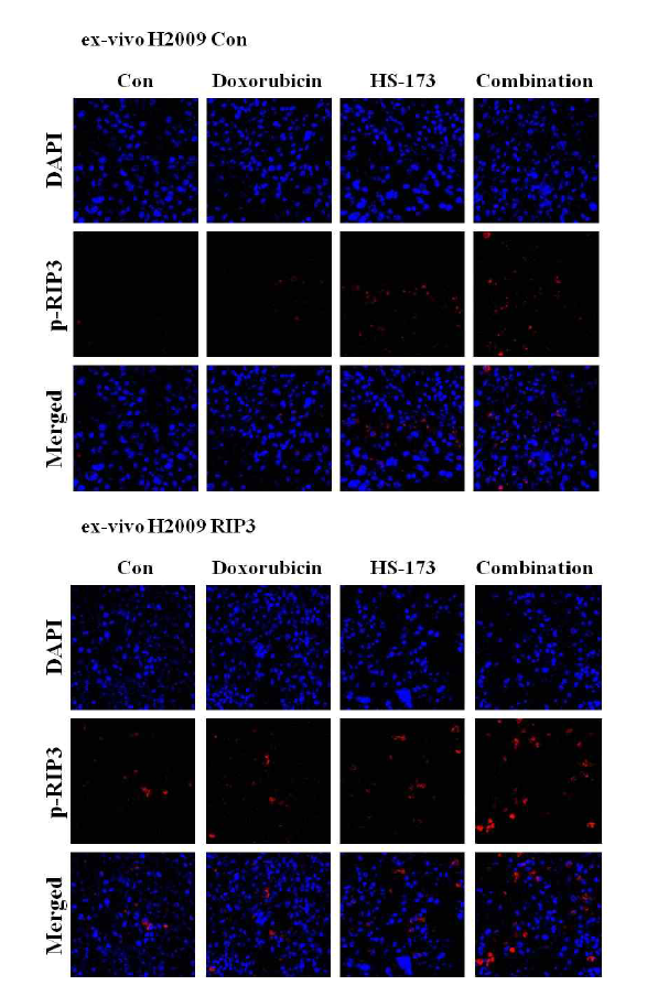 폐암 ex-vivo 모델에서 HS-173과 Doxorubicin에 대한 p-RIP3 염색