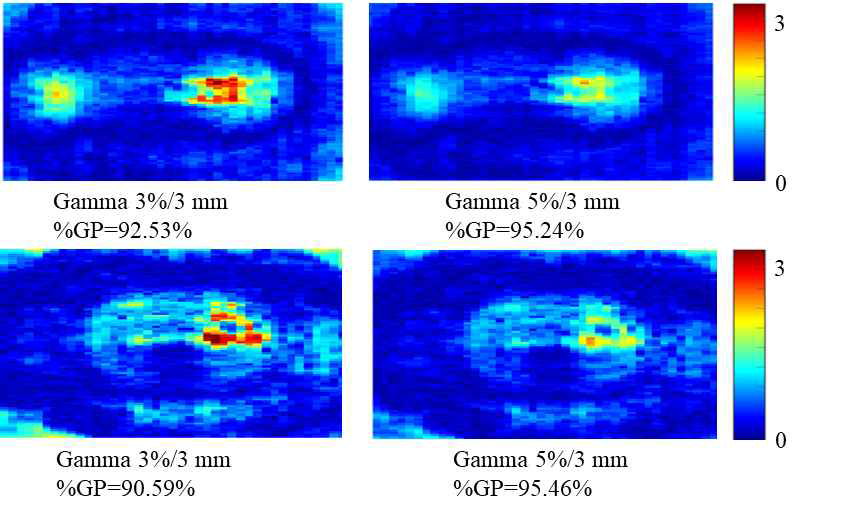 인체모사 팬톰 내 직장 윗부분의 필름 선량 측정값과 계산 결과 값의 gamma evaluation distribution; 위) 3 cm applicator 인체모사 팬톰, 아래) 4 cm applicator 인체모사 팬톰