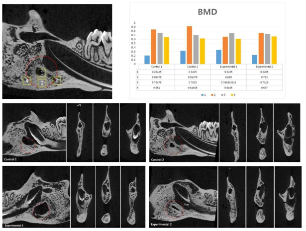 Micro CT 의 리컨스트럭션을 위한 부위 기준과 BMD 측정, 그리고 군별 비교모습