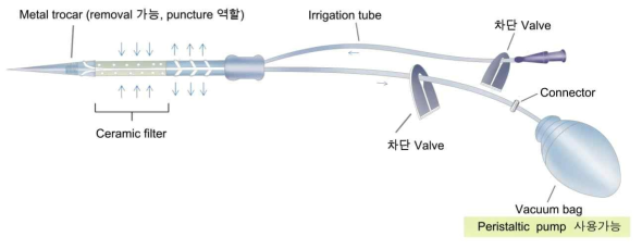 술전 의료용 소형감압기 초창기 모식도