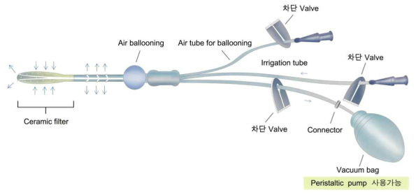 술후 의료용 소형감압기 초창기 모식도