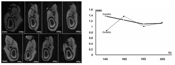 Micro CT 분석을 통한 시티 이미지 및 BMD 통계 그래프