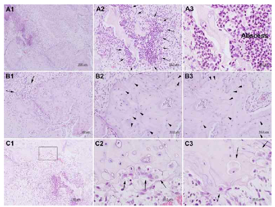 Histological findings with 18 Gy irradiation showing more dead bone than the bones irradiated with 16 Gy dose and the presence of resorption with osteoclast cells. The abscess (A1, A2, A3; arrow), inflammatory infiltrate (B1; arrow) and empty osteocytic lacunae (B2, B3; arrow head) were observed. The close-up of box in the C1 was magnified as C2. There are numerous osteoclast cells was observed in radionecrotic lesions border line. A1, A2 arrow, A3: abscess and abscess border line; B1 arrow: inflammatory cell; B2, B3 arrow head: empty osteocytic lacunae; C1,C2 arrow: osteoclast cells C3: internal osteoclast cells. A1,A2: resorption line; A3 arrow: inflammatory cell; B1,B2,B3 arrow head: empty osteocytic lacunae; C1,C2,C3 arrow: osteoclast cells; C3 arrow head: dead bone border line