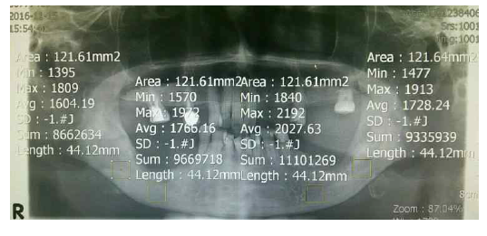 Measure area rectangle을 이용하여 평균 흑화도를 분석하는 기본적인 예시