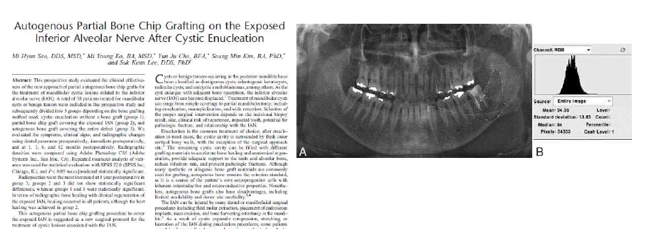 Measurement of radiographic density using Adobe Photoshop CS5 (Adobe Systems Inc., San Jose, CA)