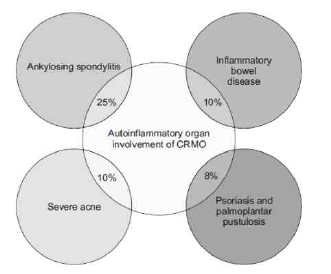 Schematic drawing showing the autoinflammatory organ involvement of chronic recurrent multifocal osteomyelitis (CRMO)