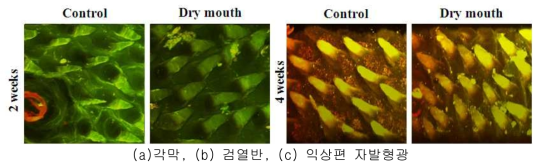 이광자 현미경을 이용한 손상모델에서의 혀 표면 손상 Two Photon Microscopy사진