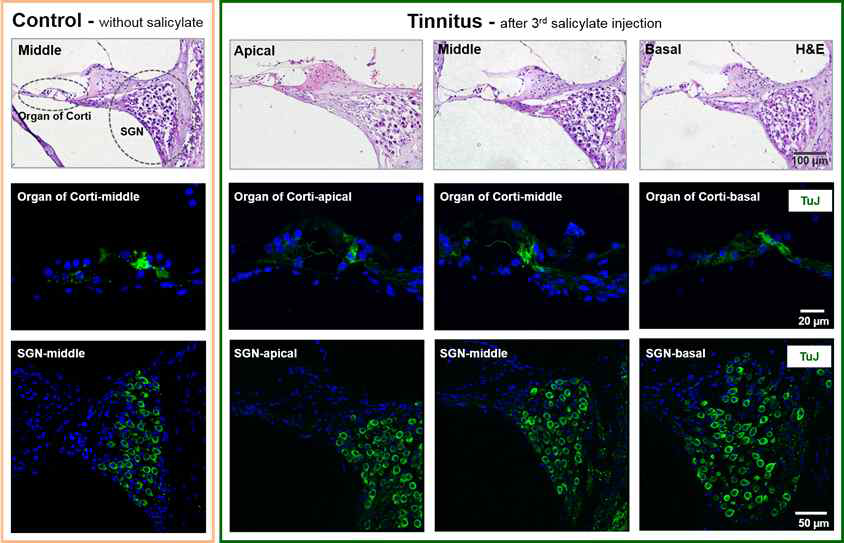 약물유도 이명의 말초 청각기관의 조직학적 변화