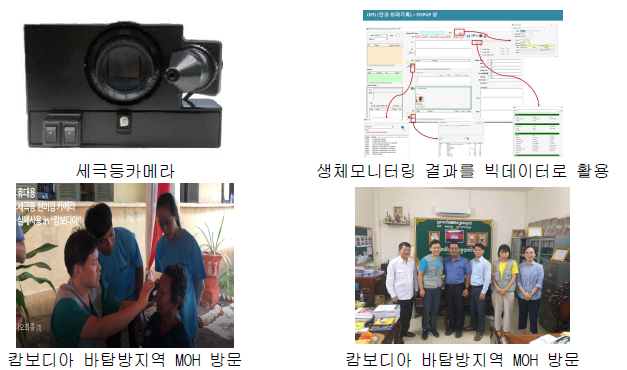 휴대용 세극등 카메라와 캄보디아 의료봉사