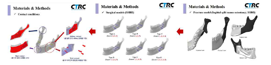 생체역학적 분석을 위한 하악골 유한요소모델 구현