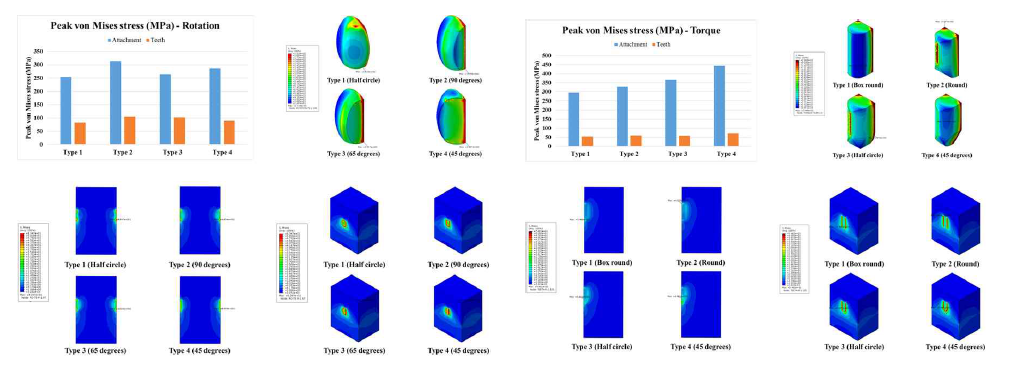 회전 및 토크용 모델의 치아, 골 및 어태치먼트의 하중 분포 및 응력 분포